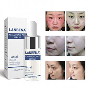 LANBENA Vitamin C Serum - Six Peptides Serum 24K Gold - Hyaluronic Acid Serum,Remove Freckle Fade Da