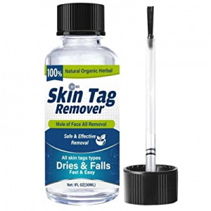 Skin-Tag-Remover Safe-and-Effective-Skin-Tag-Removal-for-Men-Women